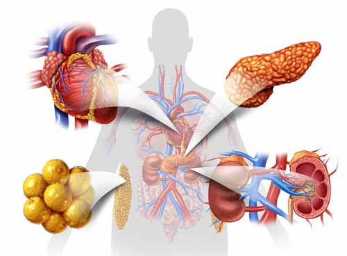 organes touches par la resistance a l'insuline